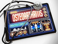 Therapeutic Exercises for Hip Osteoarthritis